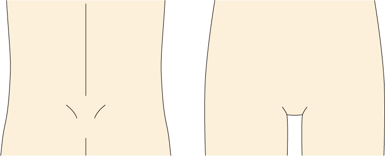 腰や足のつけ根のイラスト