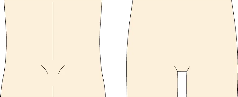 腰や足のつけ根のイラスト